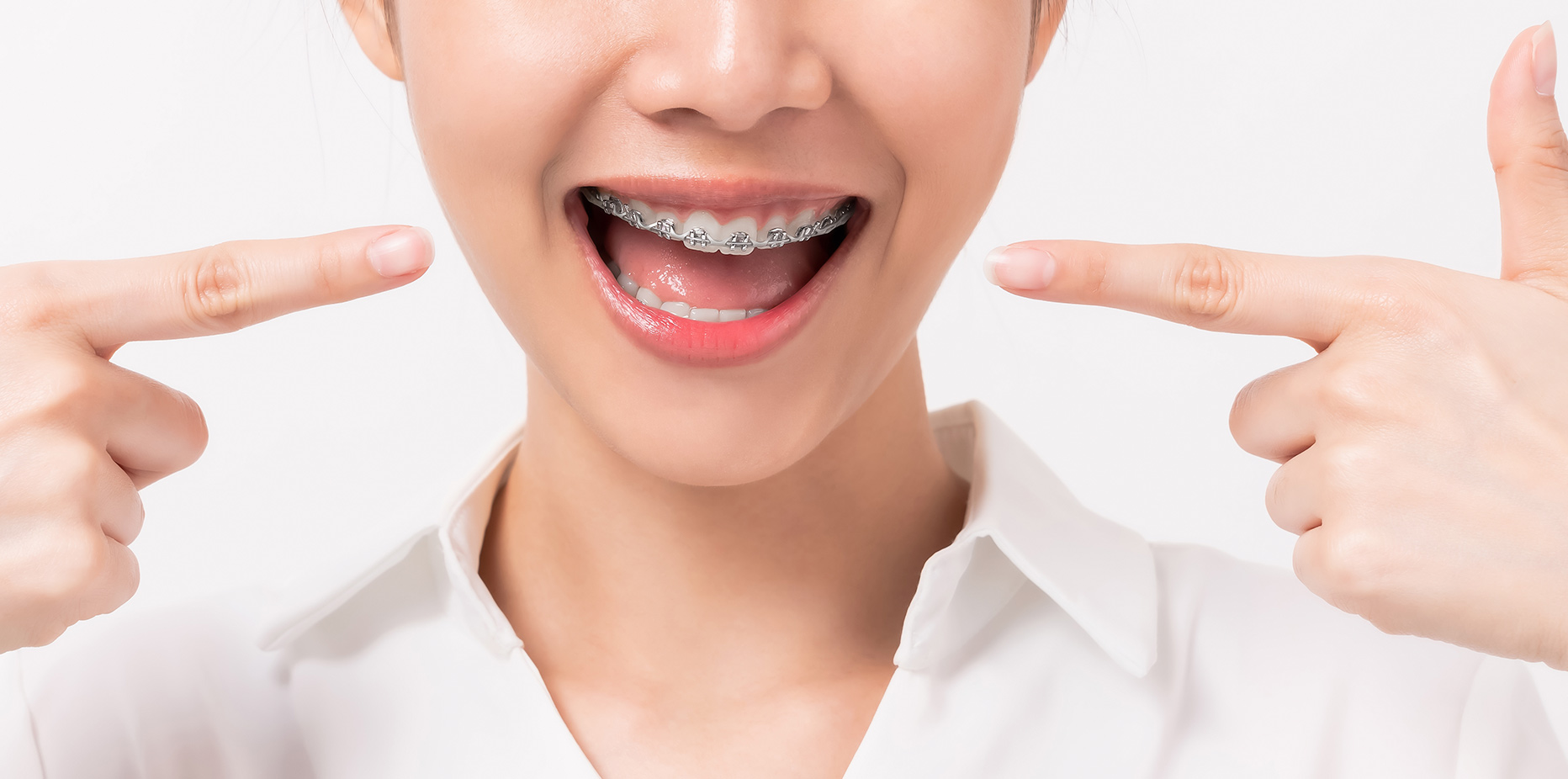 <span>Sadece 60 Saniyede</span> Yeni Gülümsemenize İlk Adımı Atın