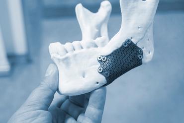 Alt Çenenin Önde Olması